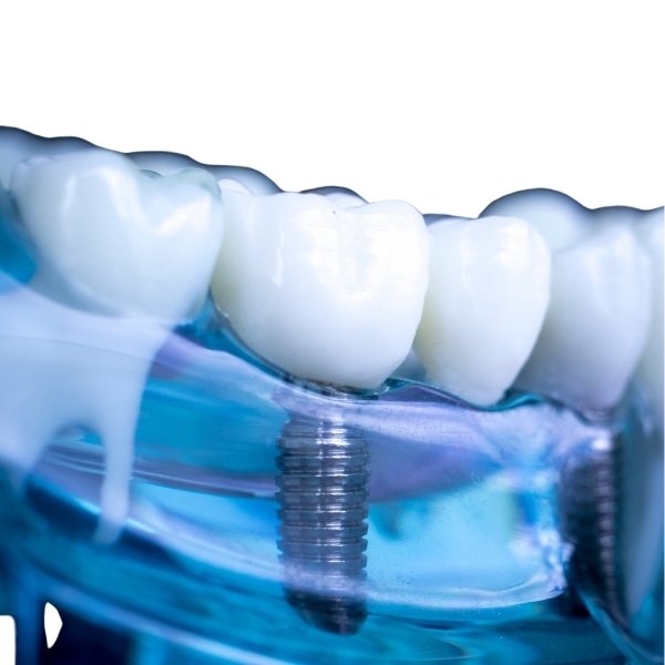 6 dentistas-
